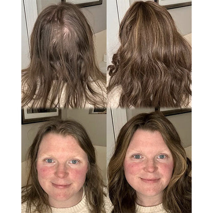 ⚡Final Hours – 2026 New Lightweight & Breathable Wavy Hair Topper