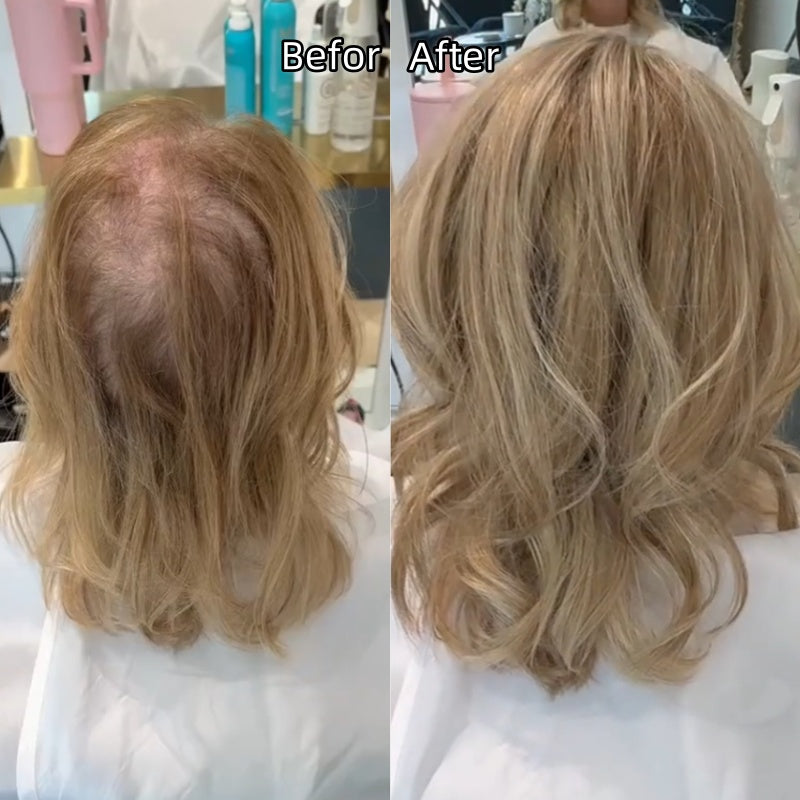 ⚡Final Hours – 2026 New Lightweight & Breathable Wavy Hair Topper